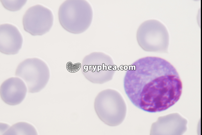 Plasmocyte x1000  - gryphea.com